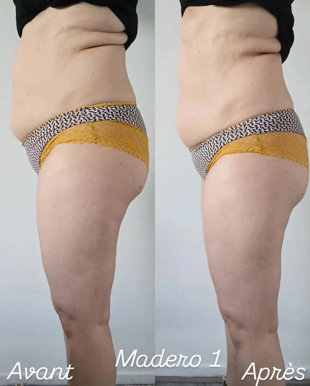 Après - Soins du corps